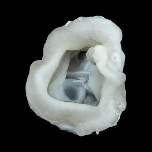 Chalcedony