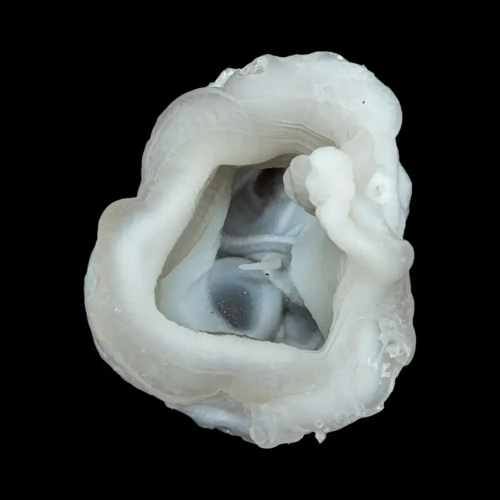 Chalcedony