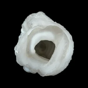 Chalcedony